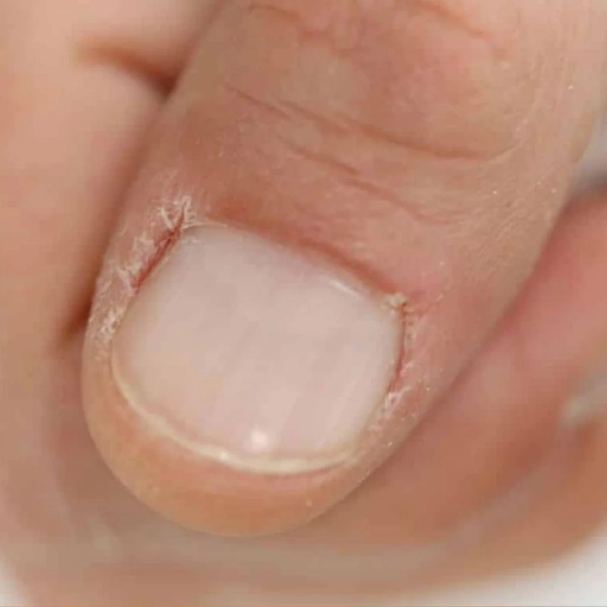 A hidratar a cutícula