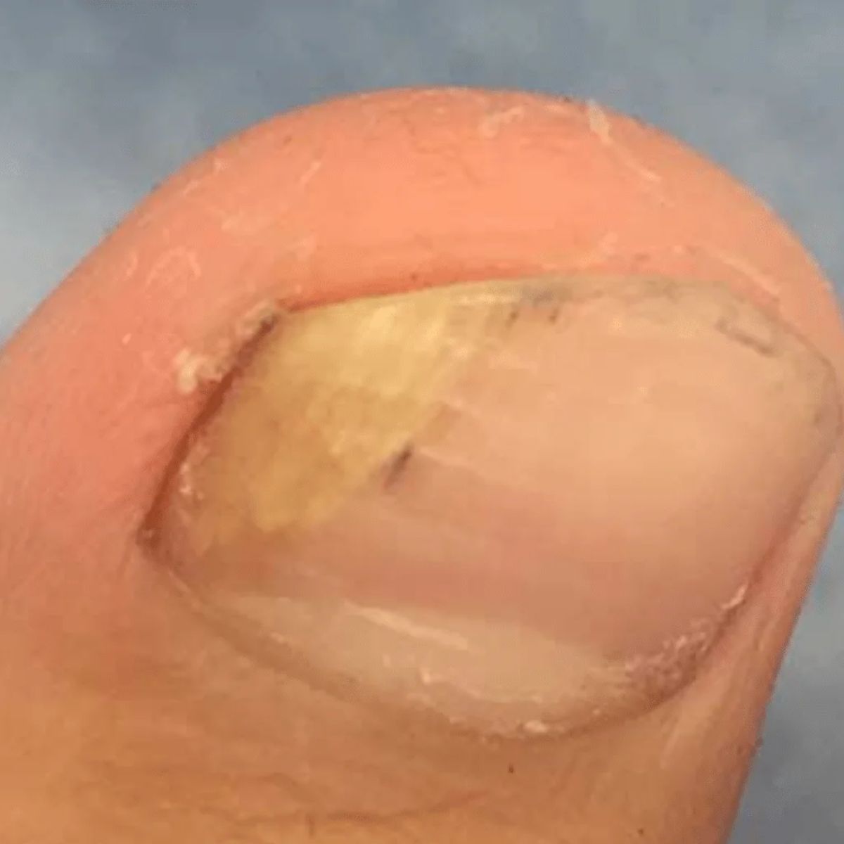 A tratar manchas brancas e amareladas