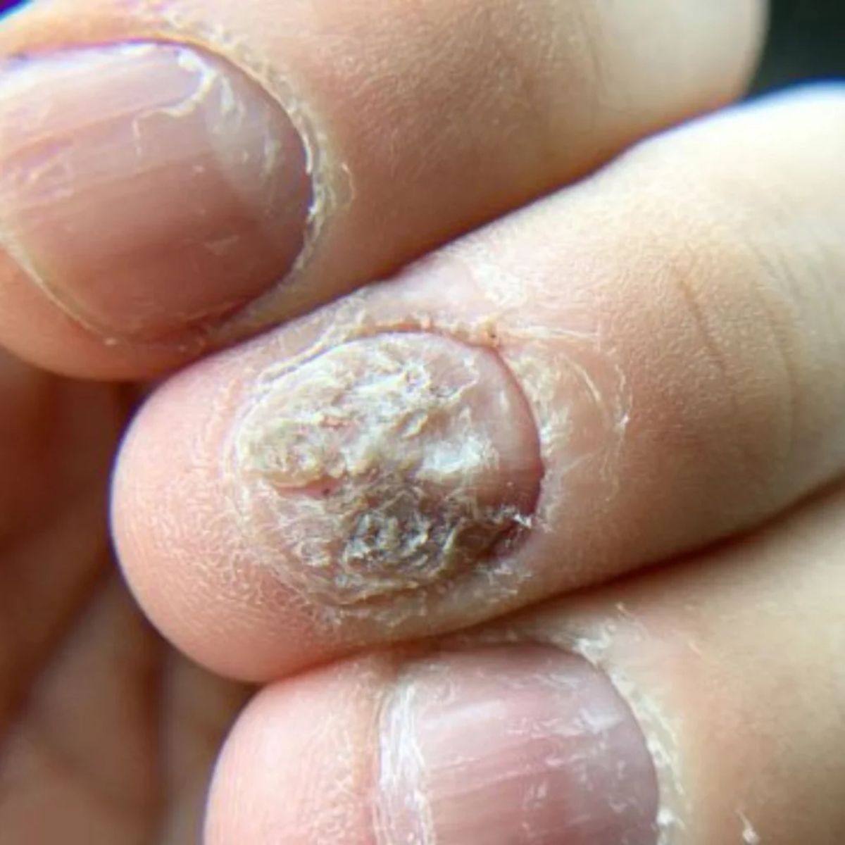 Corrigir deformidades