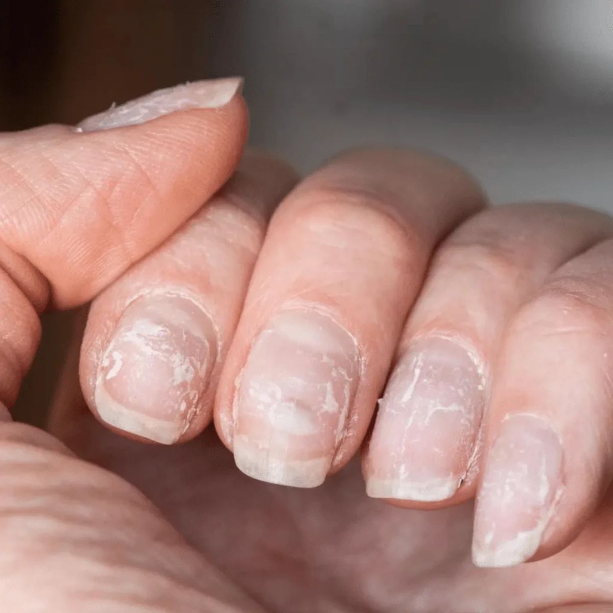 Fortalecimento de Unhas