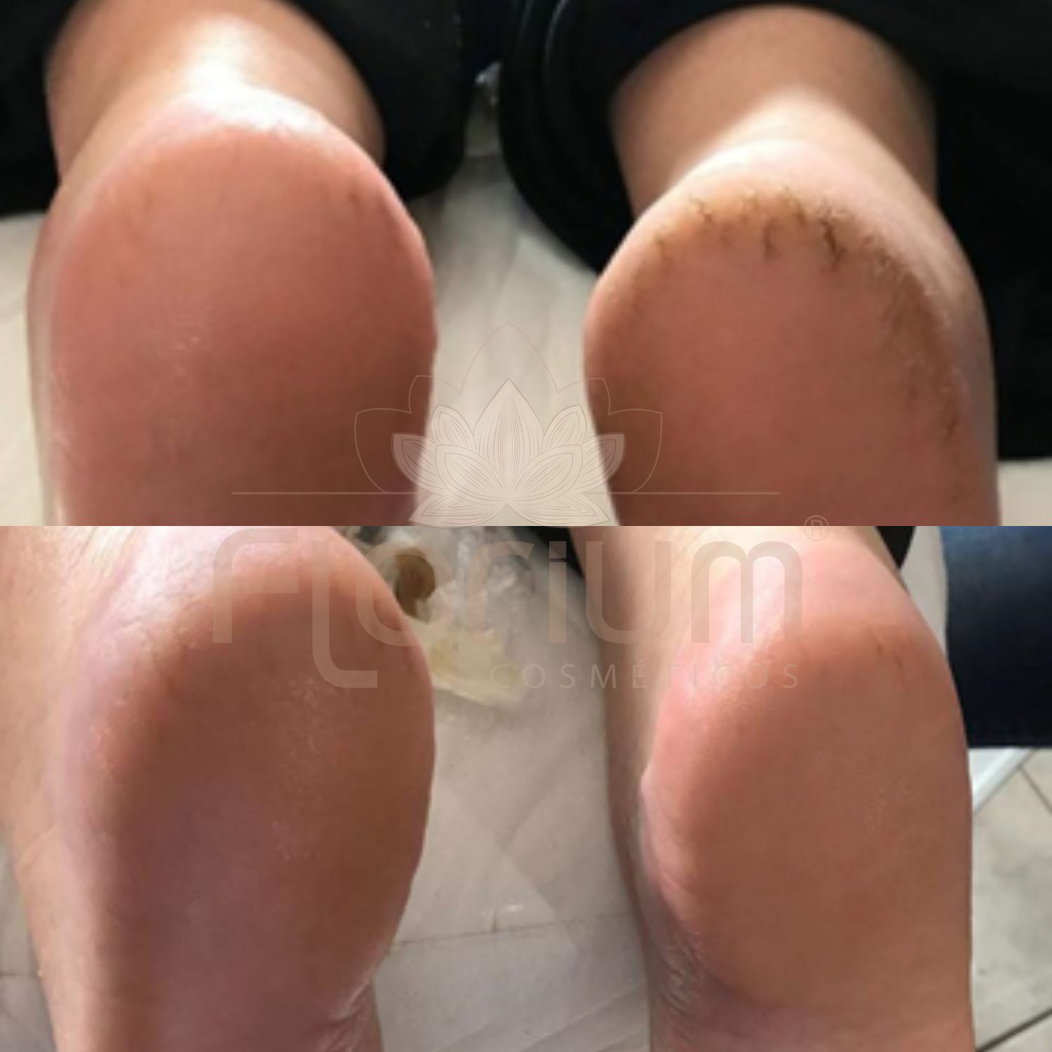 Resultados Creme dos pés (1)