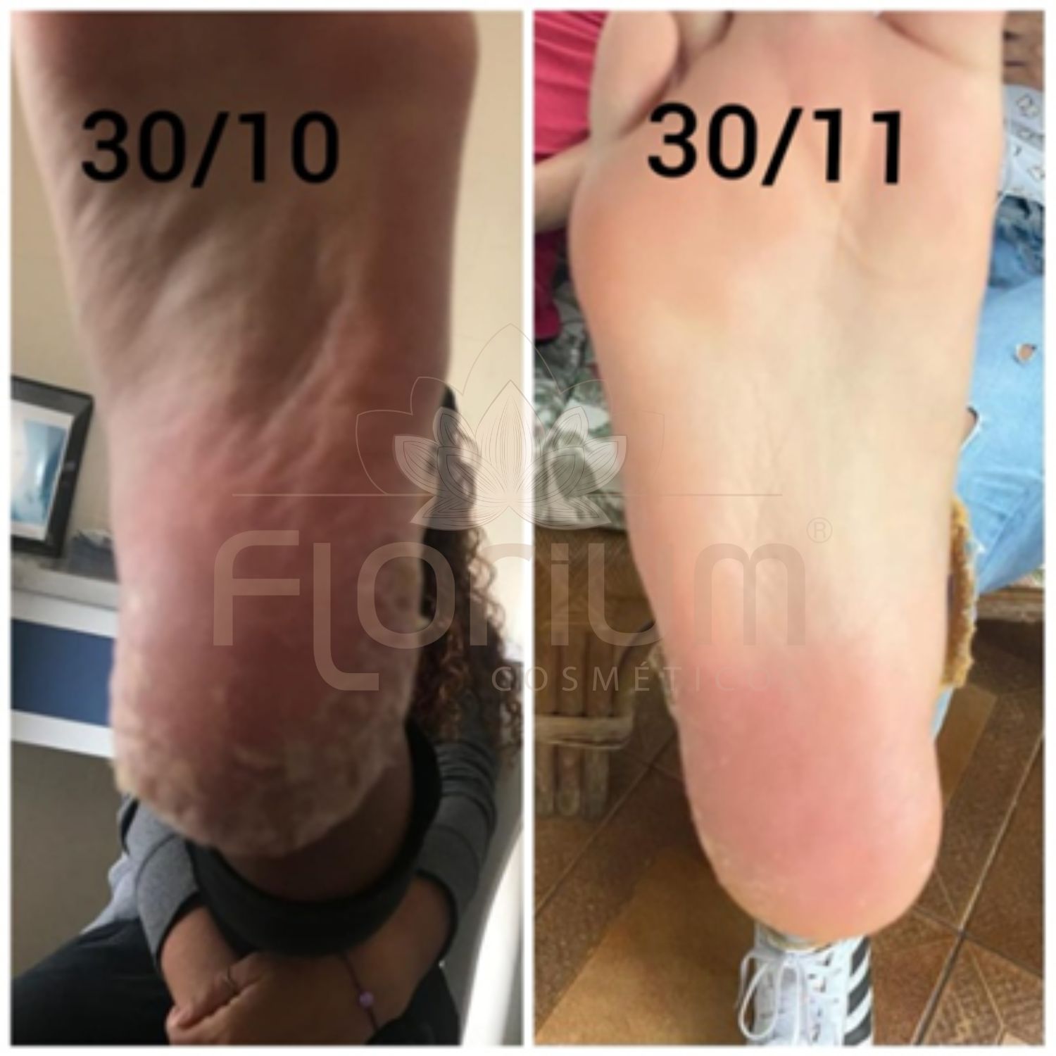 Resultados Creme dos pés (2)