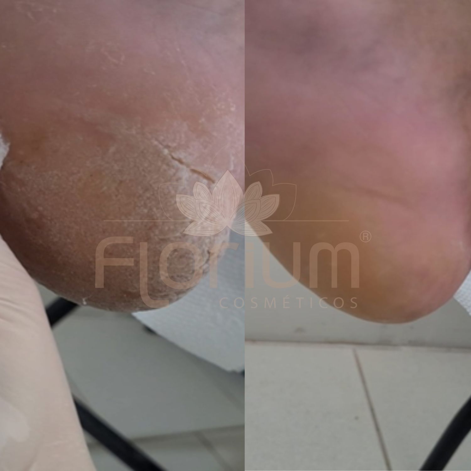 Resultados Creme dos pés (4)